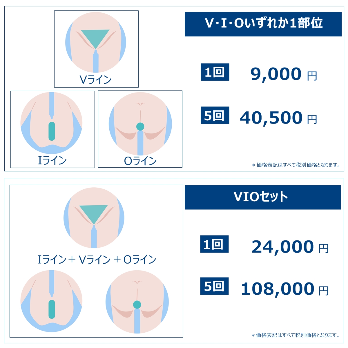 痛みの少ないメンズvio脱毛なら 静岡美容外科橋本クリニック