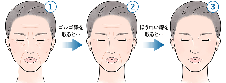 4月8日、シワの日
