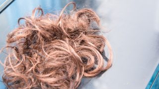 女性の薄毛（FAGA）治療　静岡美容外科橋本クリニック