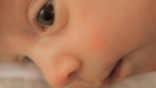 二重手術キャンペーン継続のお知らせ！