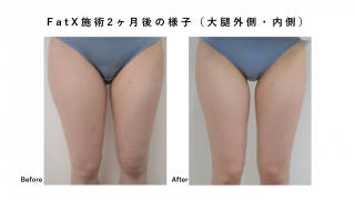 FATX COREのモニター様の紹介です。