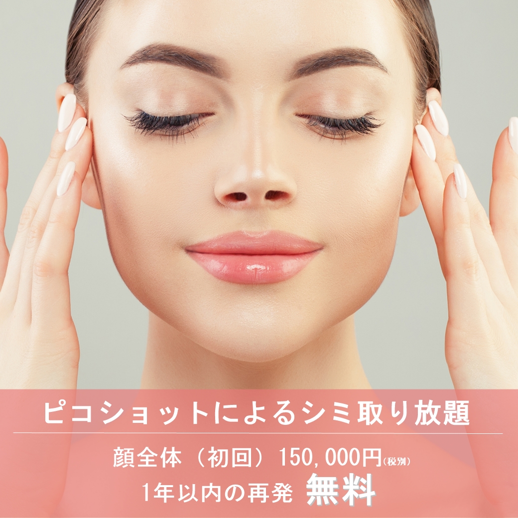 絶対消えるシミ治療プラン登場！？ピコショット1年以内再ショット無料について！