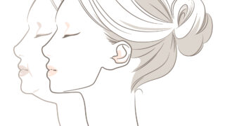 お顔の脂肪吸引と新しい糸リフトについて！小顔になりたい方へ