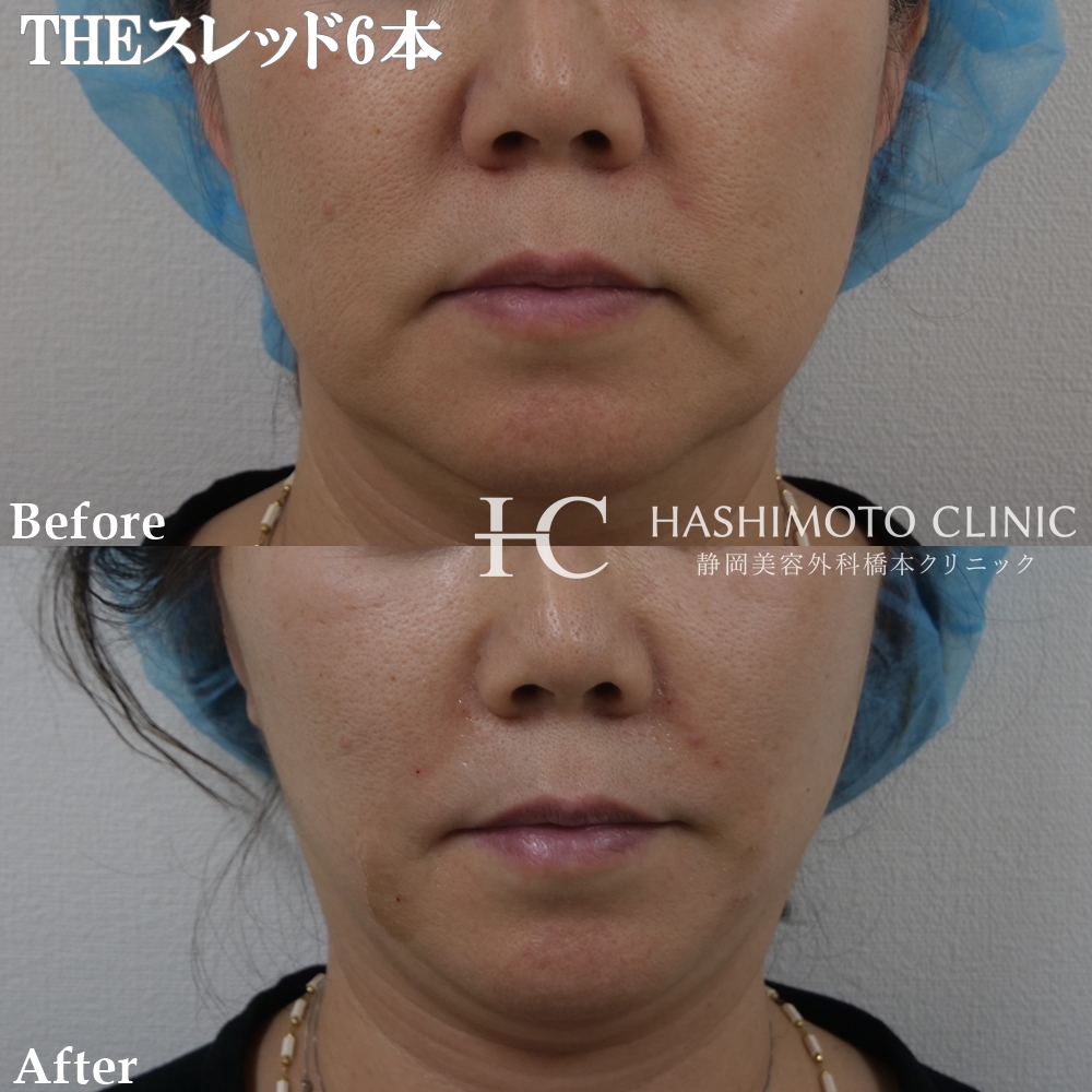 THEスレッドのモニター様のご紹介です！