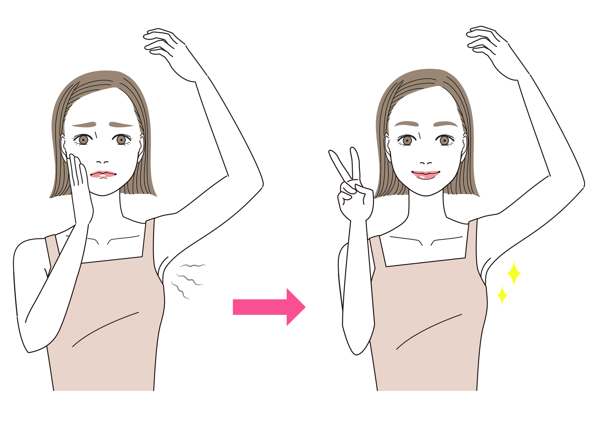 【症例紹介】他院で2回失敗したワキガ手術！しつこい汗腺を完全撃破の巻き！