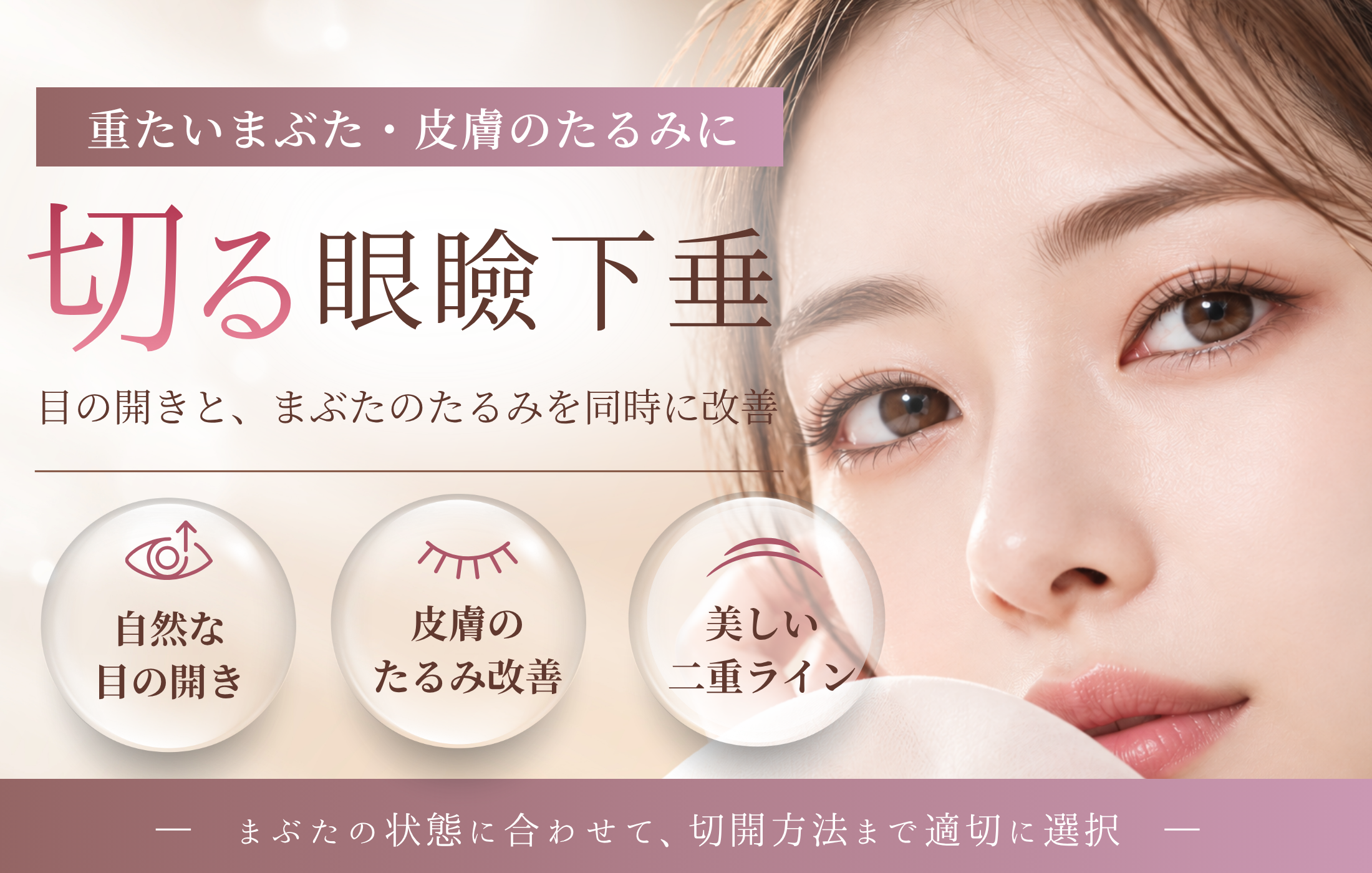 目の上たるみ取り（切る眼瞼下垂）