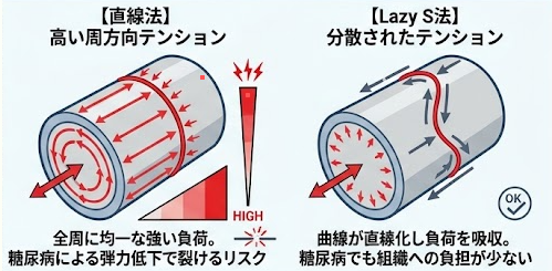 糖尿病に伴う包皮炎治療ver2.0のお知らせ！