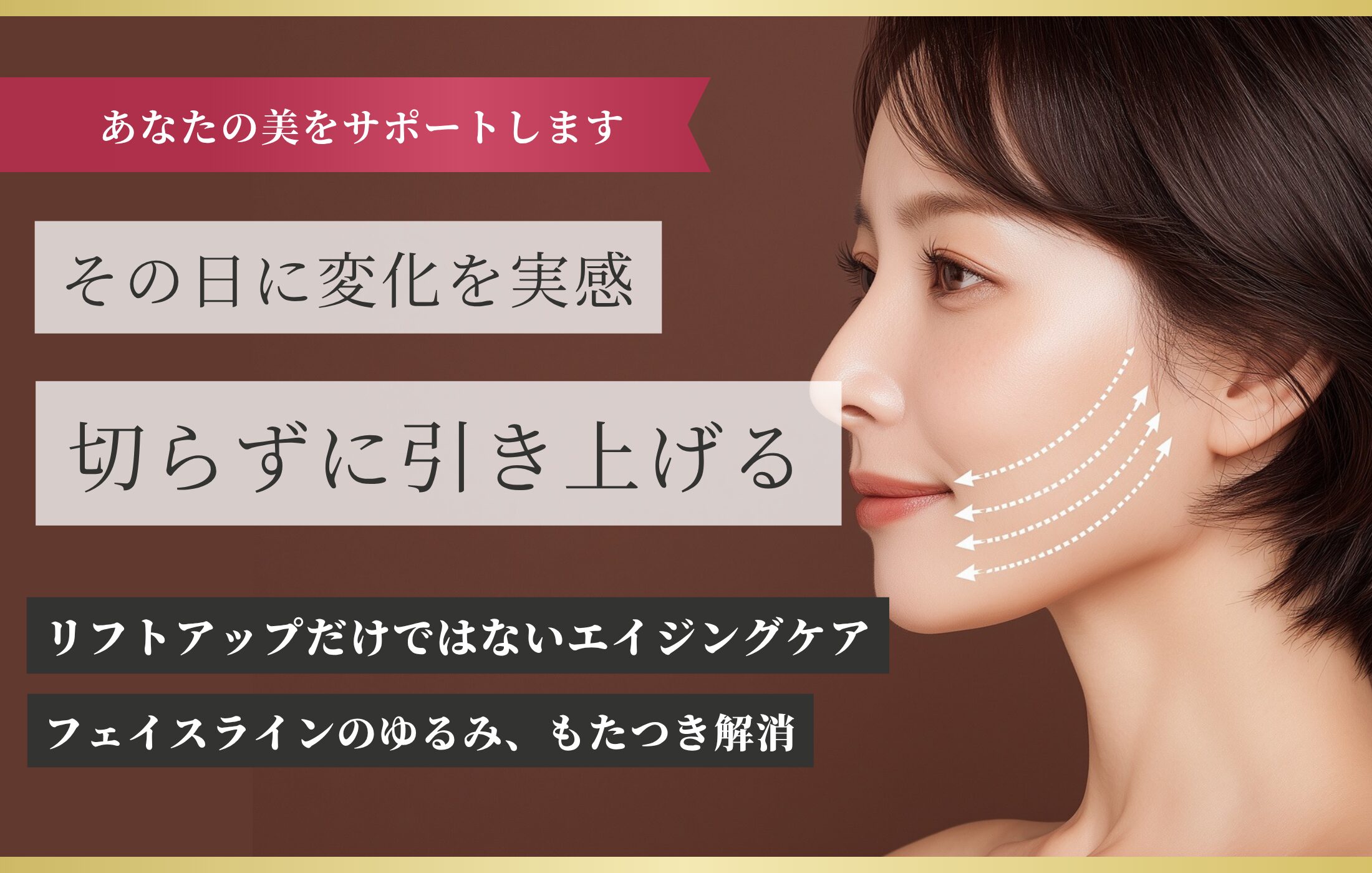 糸によるリフトアップ