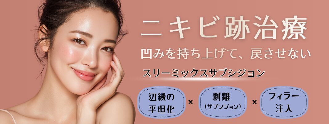 ニキビ跡治療