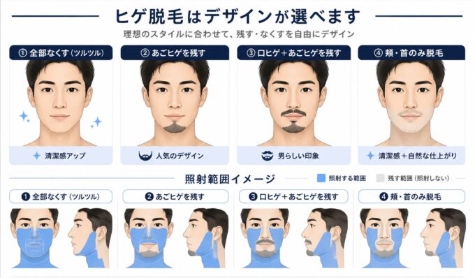 ひげ脱毛のデザインについて