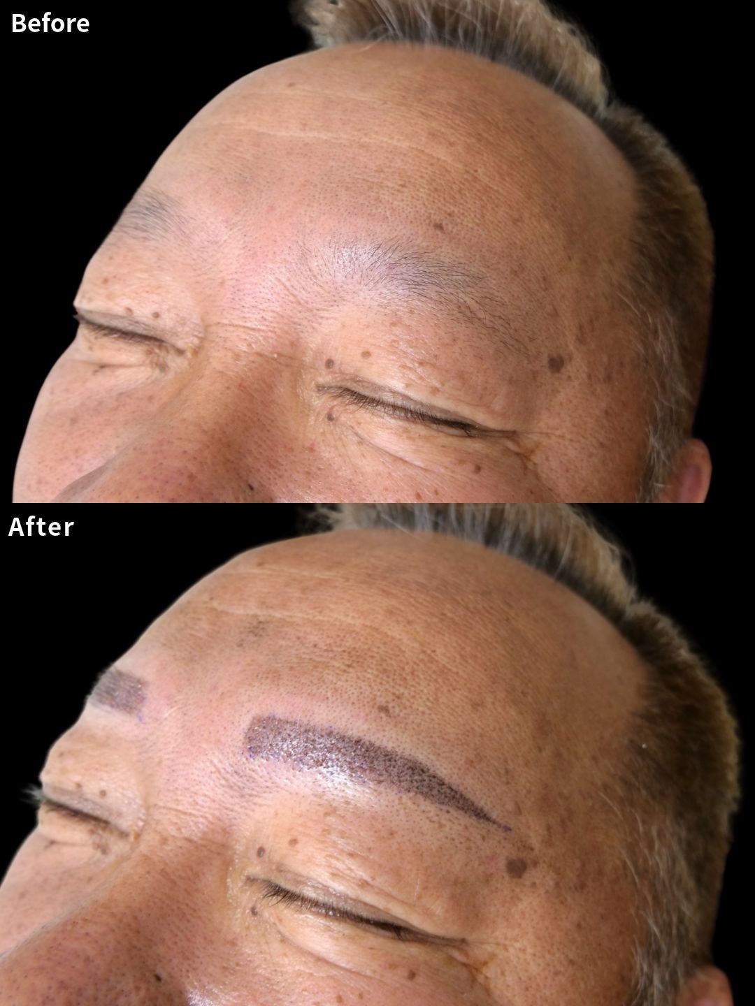 ＃365（60代 男性）眉アートメイク